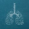 Improving survival from lung cancer in Europe